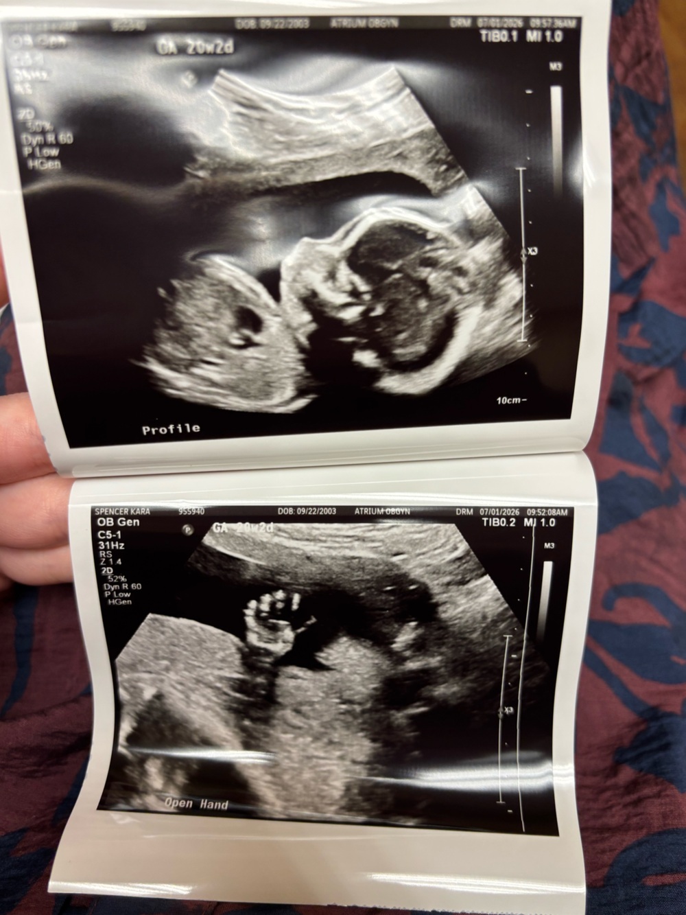 ♡meet me♡ - Picture 2 of 9
